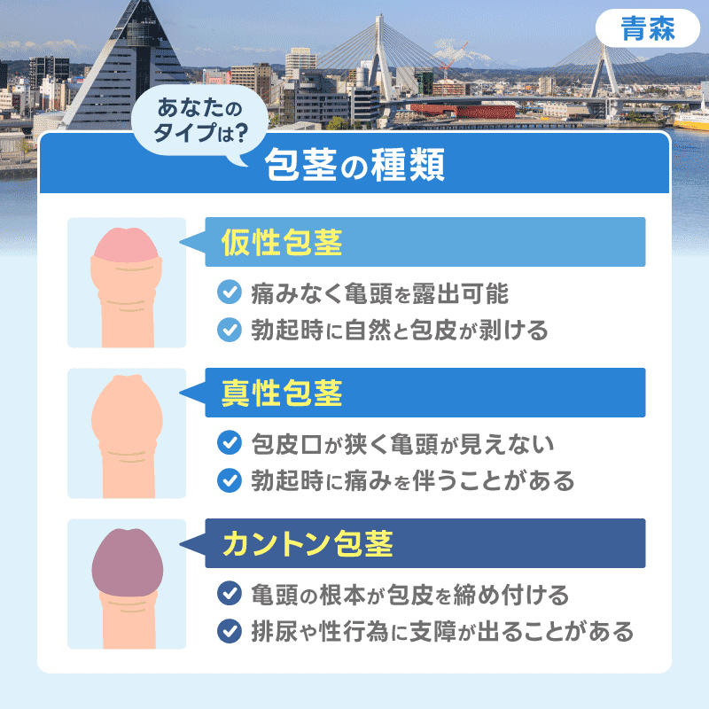 青森 包茎手術 包茎の種類