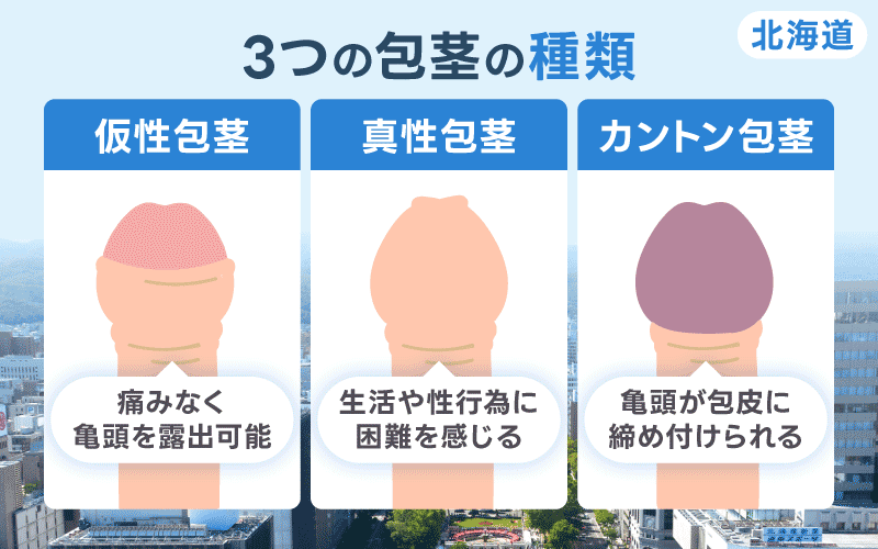 北海道 包茎 種類